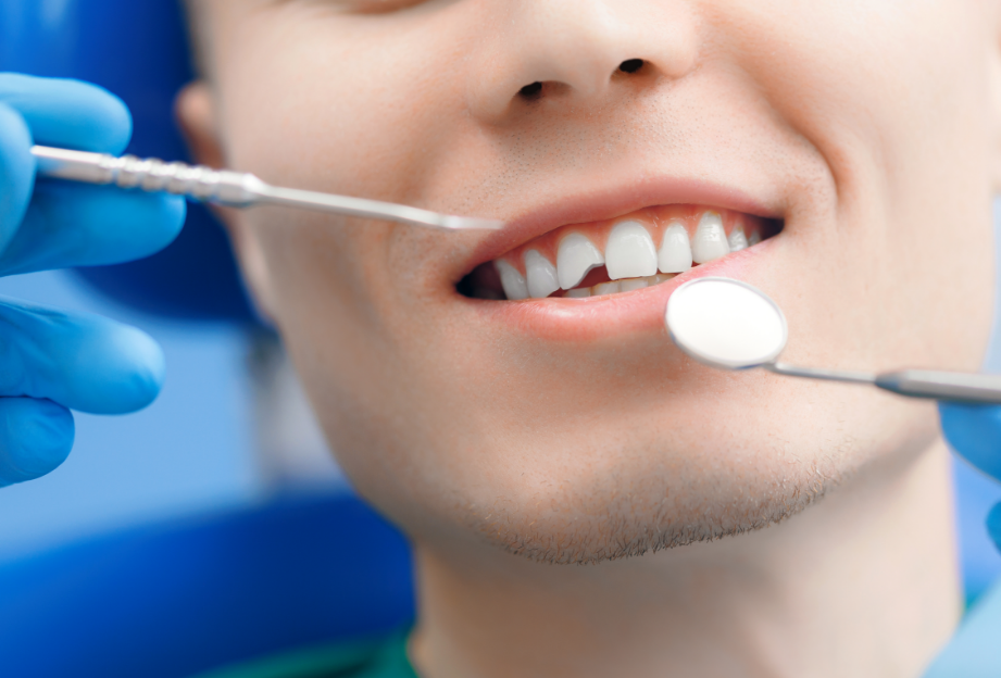 Man with chipped tooth