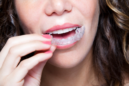 woman holding her Invisalign clear aligners