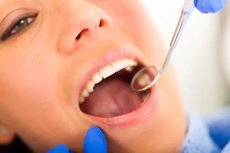 dentist examining patient's mouth before a root canal at Sunnyvale Family and Cosmetic Dentistry