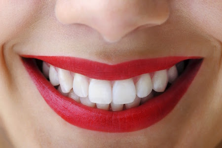 woman smiling after getting her teeth professionally whitened