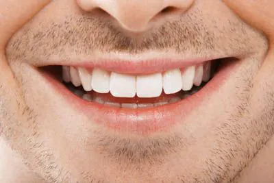 man showing off his freshly whitened smile